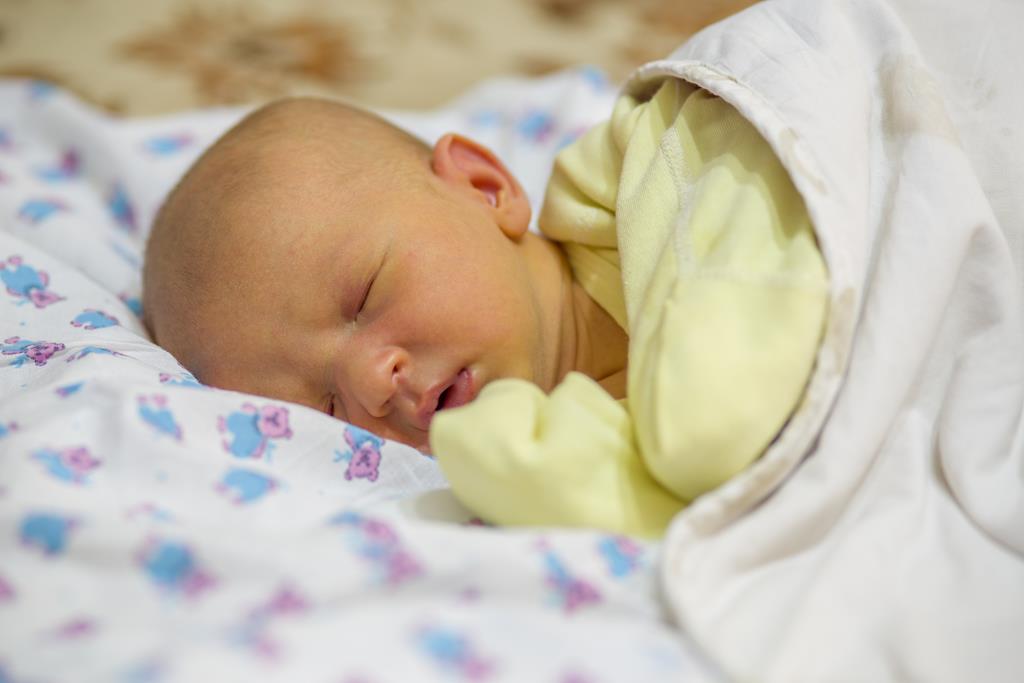 newborn baby with jaundice