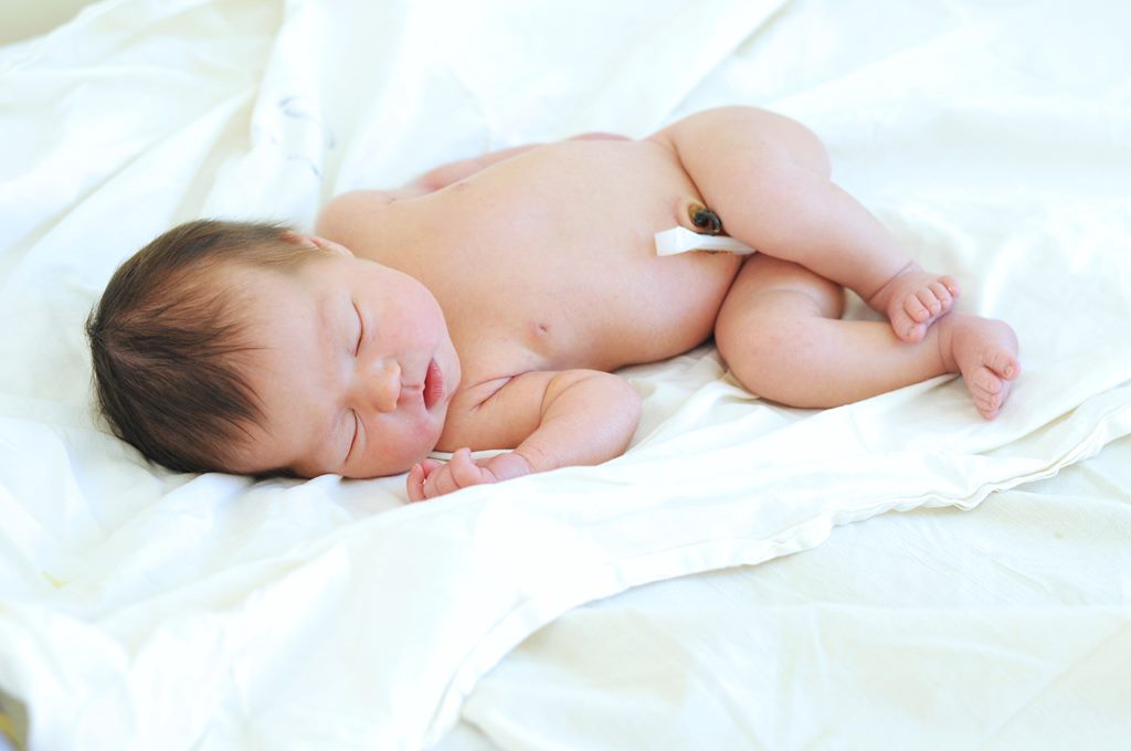 newborn baby with umbilical cord stump