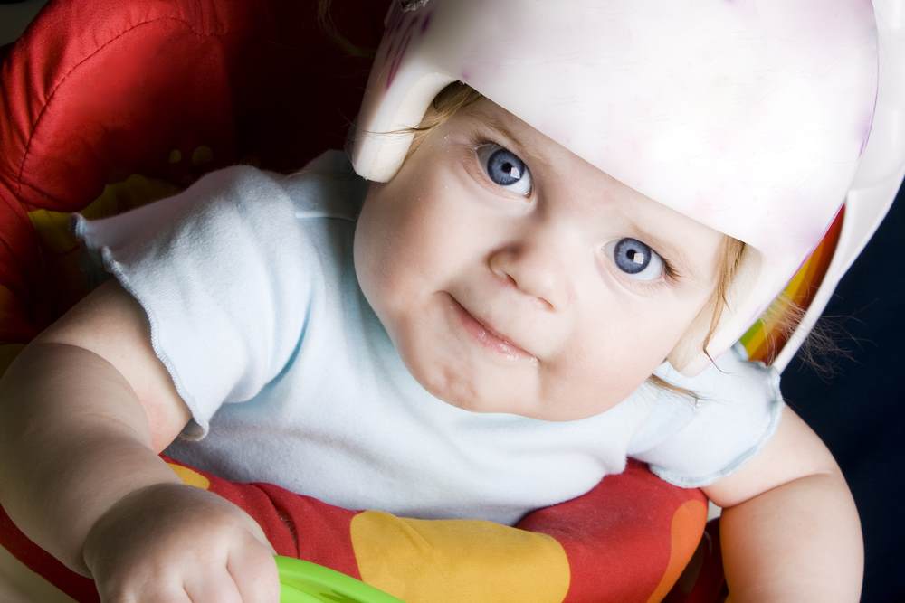 baby in helmet