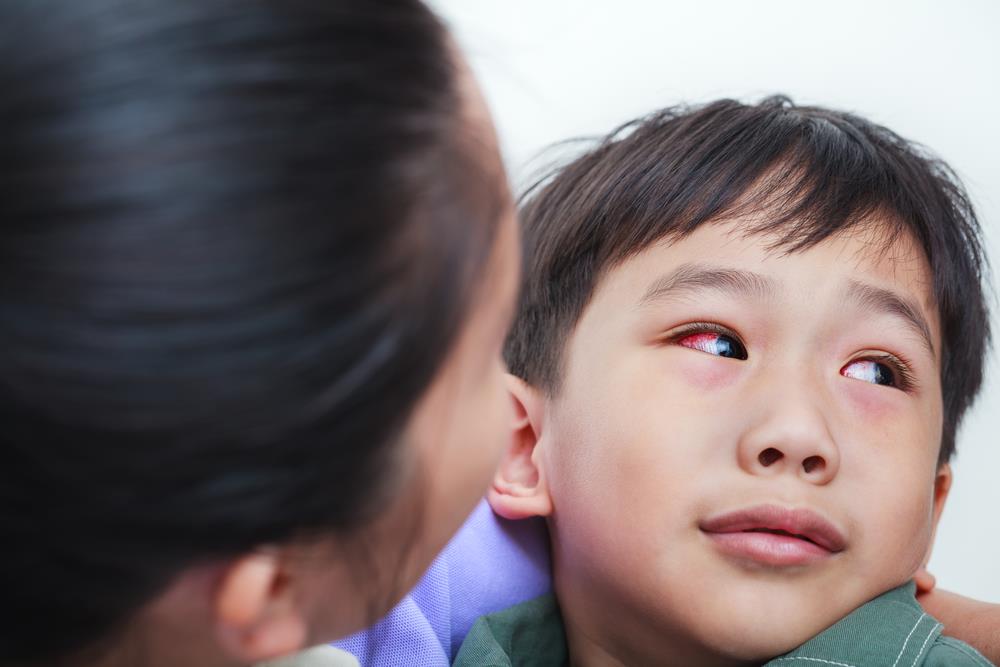 child with conjunctivitis