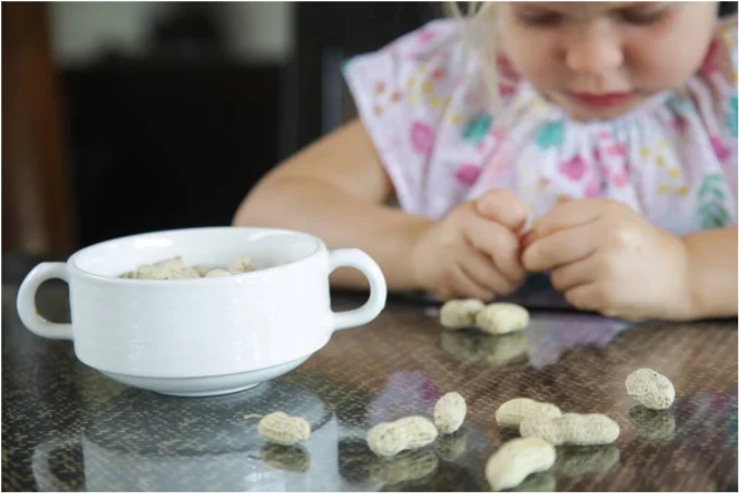 Food allergy in children